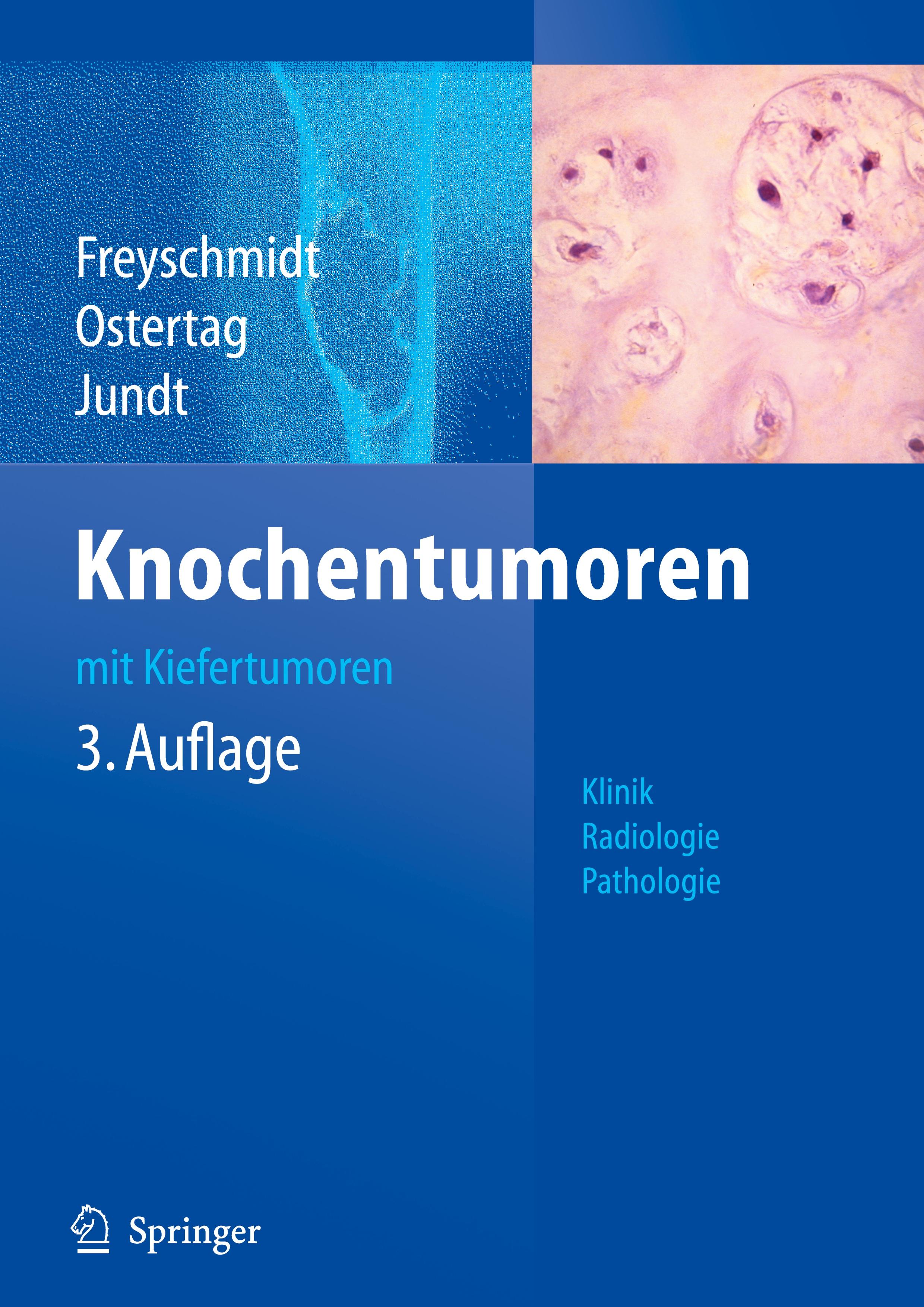 Vorderes Coverbild Knochentumoren mit Kiefertumoren