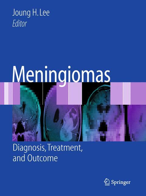 Vorderes Coverbild Meningiomas