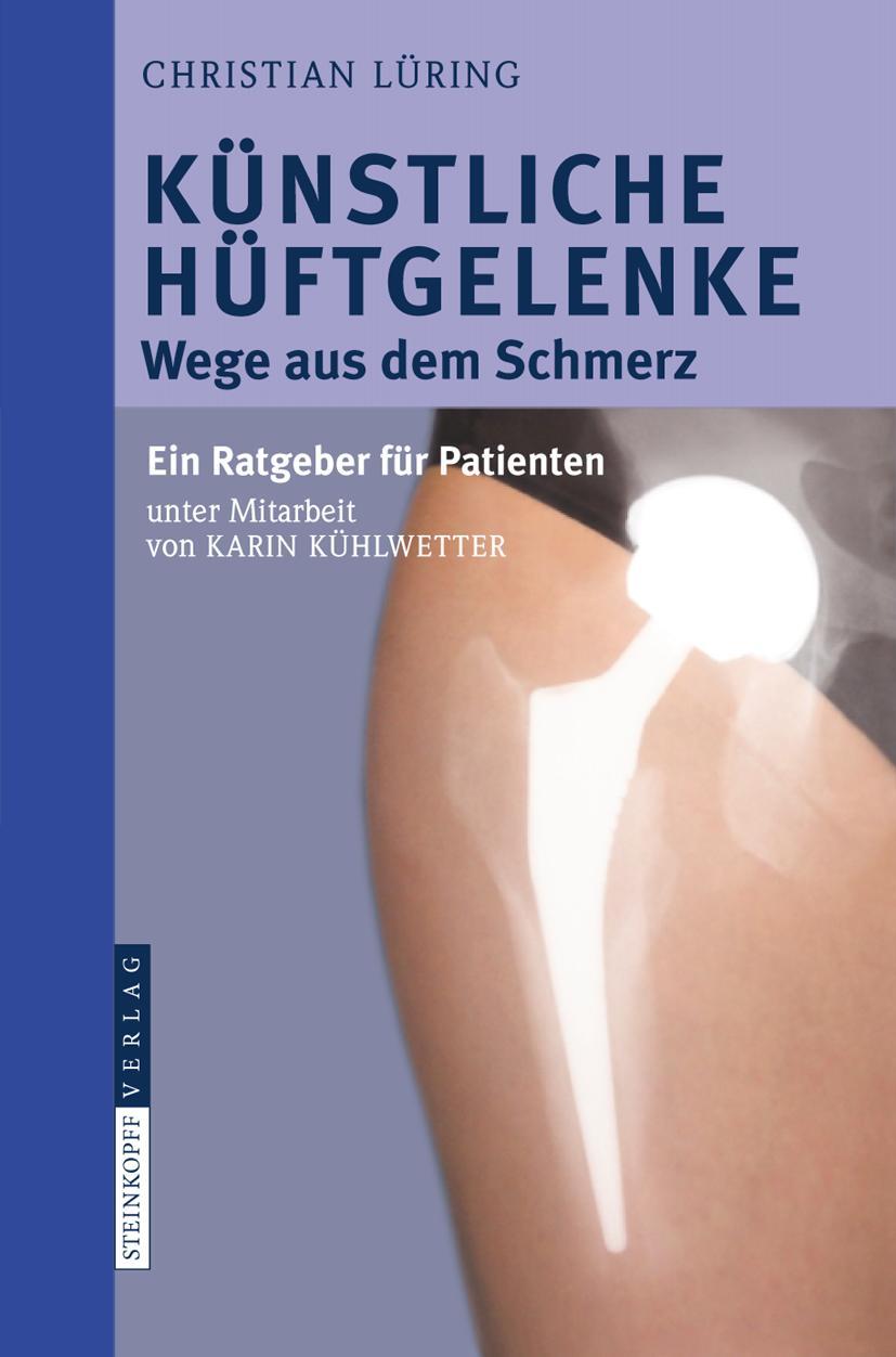 Vorderes Coverbild Künstliche Hüftgelenke