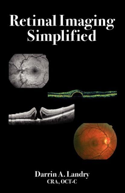 Vorderes Coverbild Retinal Imaging Simplified