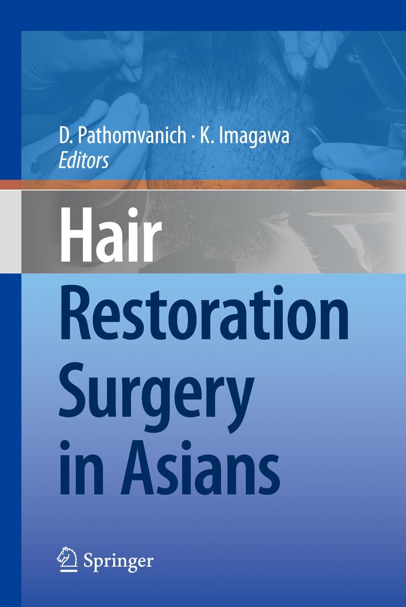 Vorderes Coverbild Hair Restoration Surgery in Asians