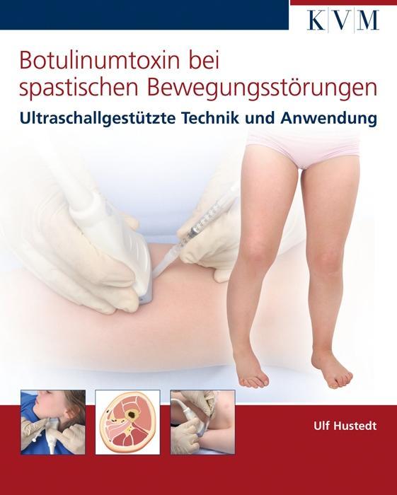 Vorderes Coverbild Botulinumtoxin bei spastischen Bewegungsstörungen