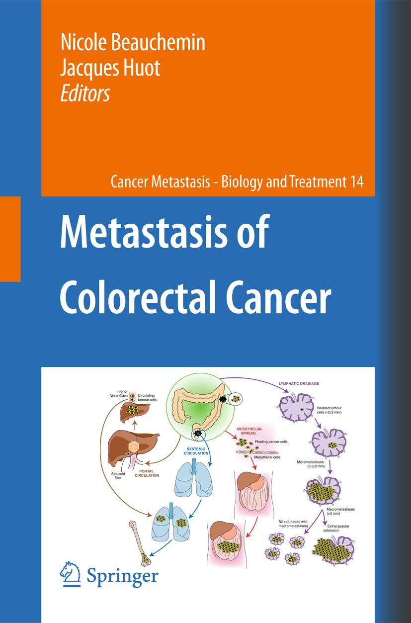 Vorderes Coverbild Metastasis of Colorectal Cancer