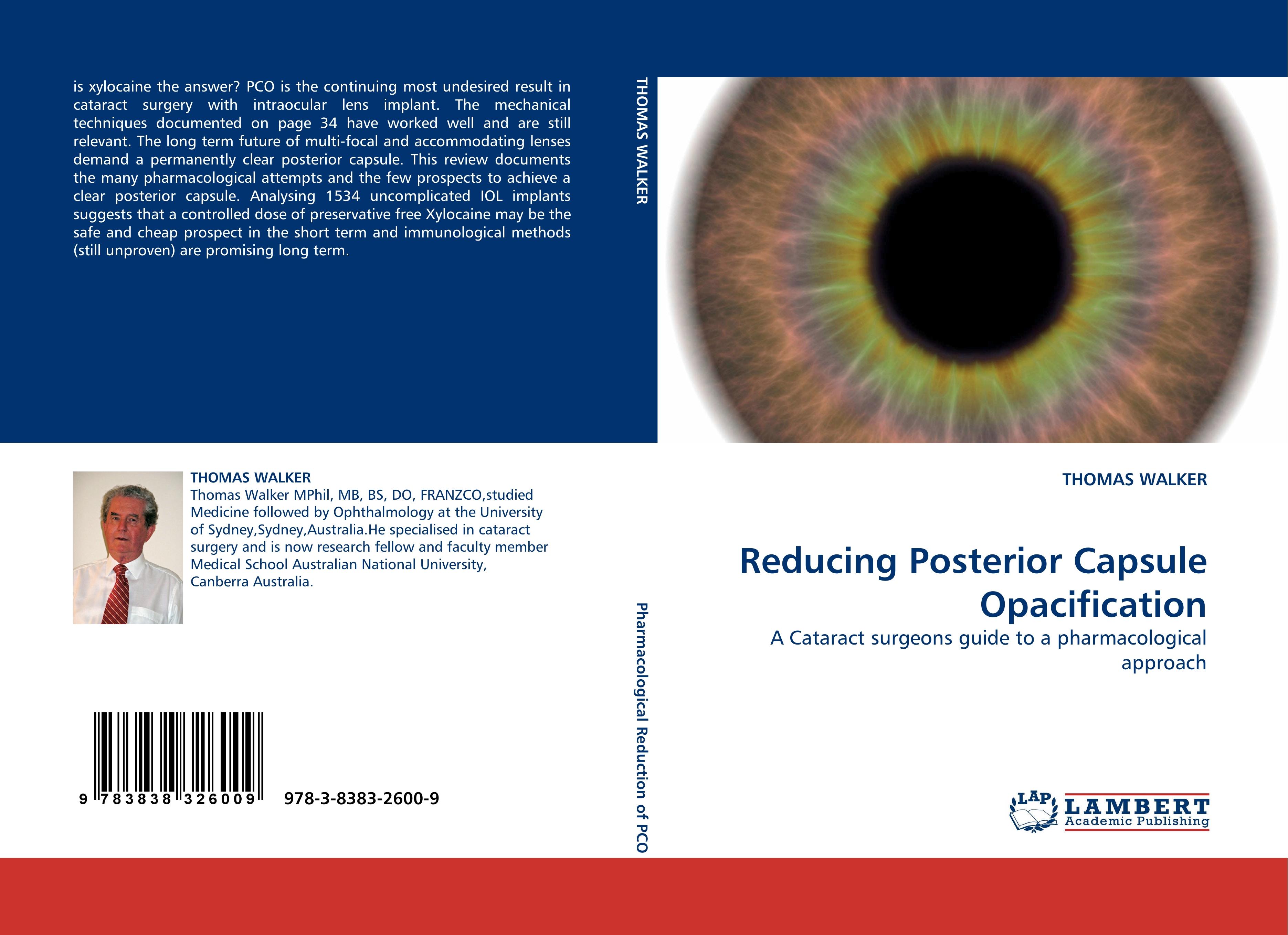 Vorderes Coverbild Reducing Posterior Capsule Opacification