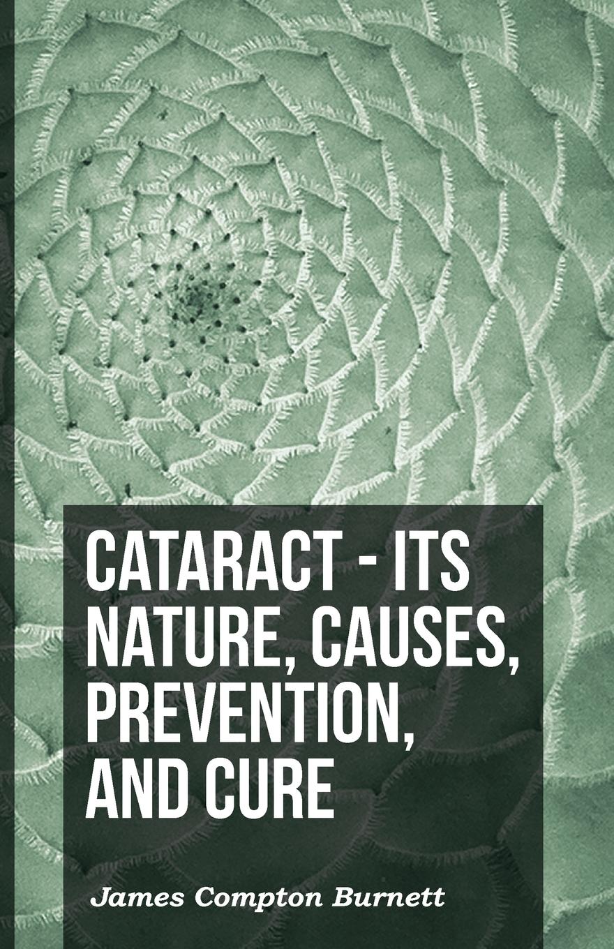 Vorderes Coverbild Cataract - Its Nature, Causes, Prevention, And Cure