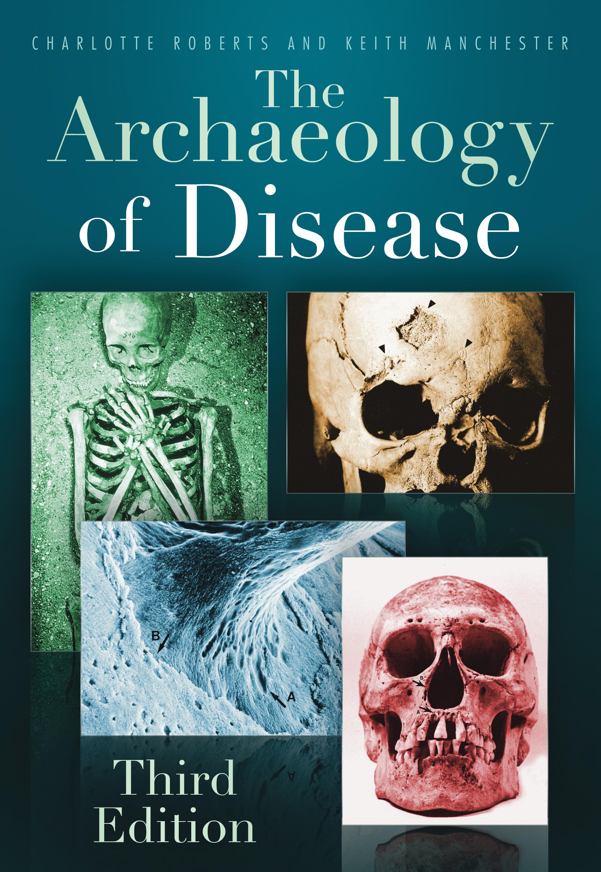 Vorderes Coverbild The Archaeology of Disease