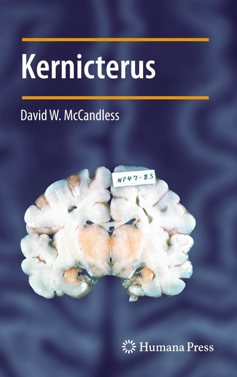 Vorderes Coverbild Kernicterus
