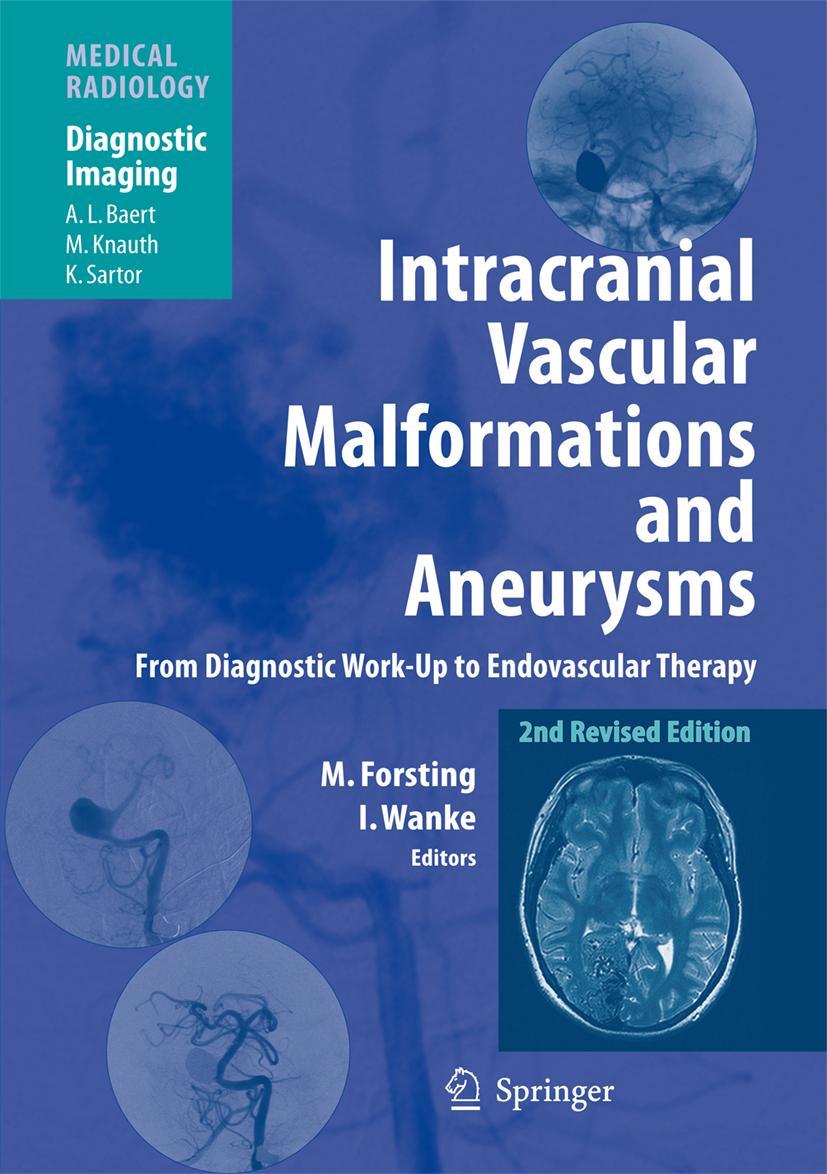 Vorderes Coverbild Intracranial Vascular Malformations and Aneurysms