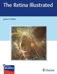 Vorderes Coverbild The Retina Illustrated