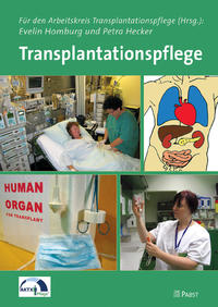 Vorderes Coverbild Transplantationspflege
