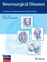 Vorderes Coverbild Neurosurgical Diseases