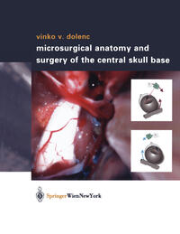 Vorderes Coverbild Microsurgical Anatomy and Surgery of the Central Skull Base