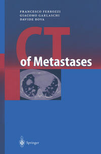 Vorderes Coverbild CT of Metastases