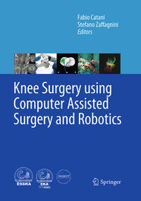Vorderes Coverbild Knee Surgery using Computer Assisted Surgery and Robotics