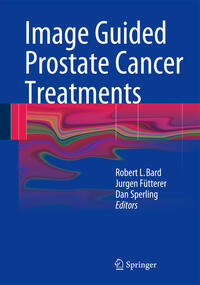 Vorderes Coverbild Image Guided Prostate Cancer Treatments