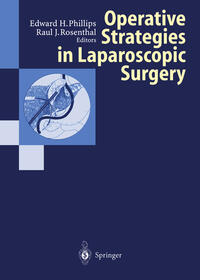 Vorderes Coverbild Operative Strategies in Laparoscopic Surgery