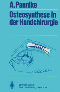 Vorderes Coverbild Osteosynthese in der Handchirurgie