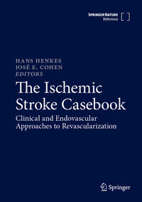 Vorderes Coverbild The Ischemic Stroke Casebook