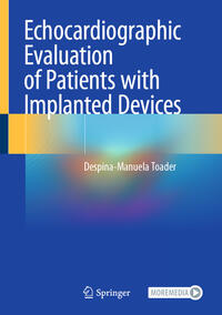 Vorderes Coverbild Echocardiographic Evaluation of Patients with Implanted Devices