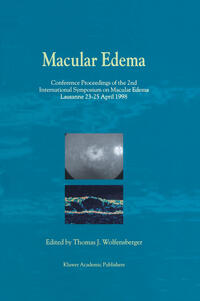 Vorderes Coverbild Macular Edema