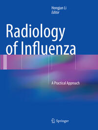 Vorderes Coverbild Radiology of Influenza