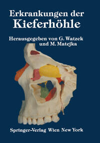 Vorderes Coverbild Erkrankungen der Kieferhöhle