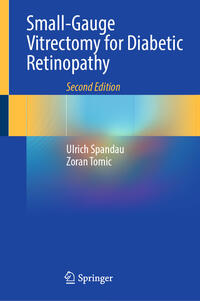 Vorderes Coverbild Small-Gauge Vitrectomy for Diabetic Retinopathy