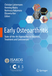 Vorderes Coverbild Early Osteoarthritis
