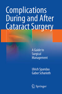 Vorderes Coverbild Complications During and After Cataract Surgery