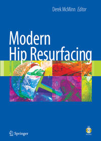 Vorderes Coverbild Modern Hip Resurfacing