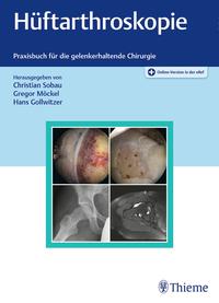 Vorderes Coverbild Hüftarthroskopie