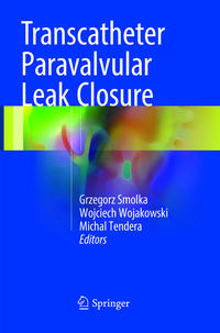 Vorderes Coverbild Transcatheter Paravalvular Leak Closure