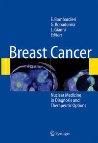 Vorderes Coverbild Breast Cancer