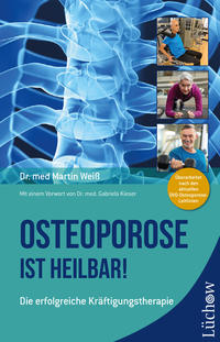 Vorderes Coverbild Osteoporose ist heilbar!