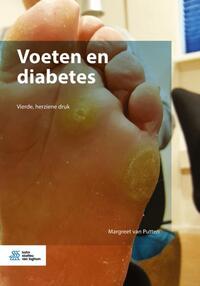 Vorderes Coverbild Voeten en diabetes