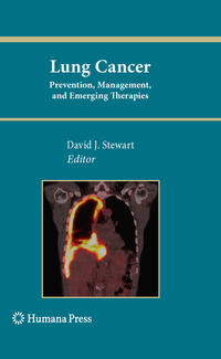 Vorderes Coverbild Lung Cancer: