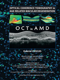 Vorderes Coverbild Optical Coherence Tomography in Age-Related Macular Degeneration