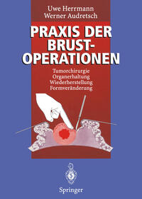 Vorderes Coverbild Praxis der Brustoperationen