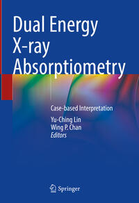 Vorderes Coverbild Dual Energy X-ray Absorptiometry