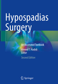 Vorderes Coverbild Hypospadias Surgery