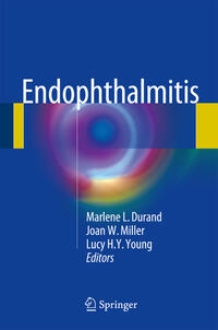 Vorderes Coverbild Endophthalmitis
