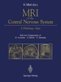 Vorderes Coverbild MRI of the Central Nervous System