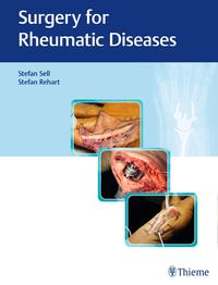 Vorderes Coverbild Surgery for Rheumatic Diseases