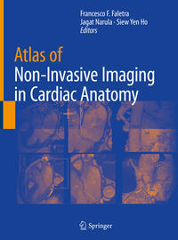 Vorderes Coverbild Atlas of Non-Invasive Imaging in Cardiac Anatomy