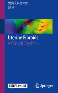 Vorderes Coverbild Uterine Fibroids