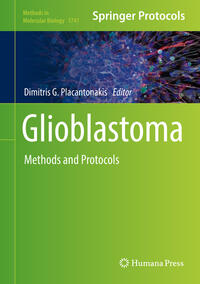 Vorderes Coverbild Glioblastoma