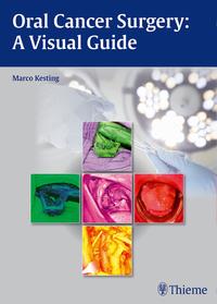 Vorderes Coverbild Oral Cancer Surgery
