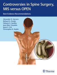 Vorderes Coverbild Controversies in Spine Surgery, MIS versus OPEN