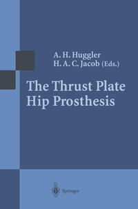 Vorderes Coverbild The Thrust Plate Hip Prosthesis