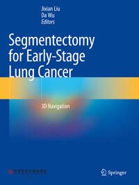 Vorderes Coverbild Segmentectomy for Early-Stage Lung Cancer